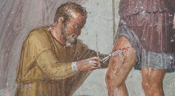 Fresco with wounded Aeneas, Pompeii