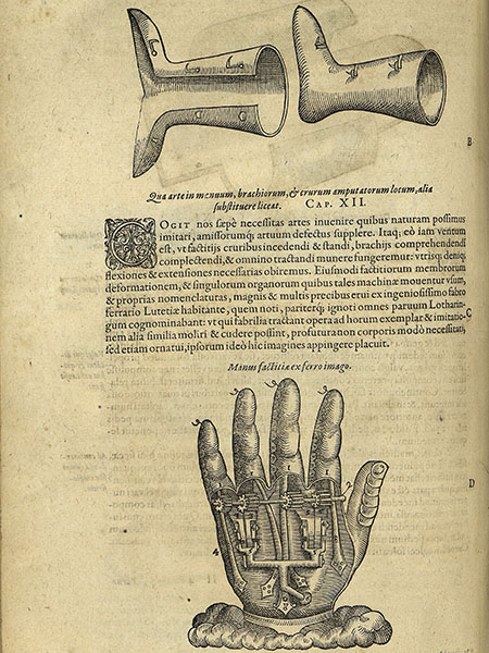 La "mano di ferro" di Ambroise Paré, da Dix livres de la chirurgie.