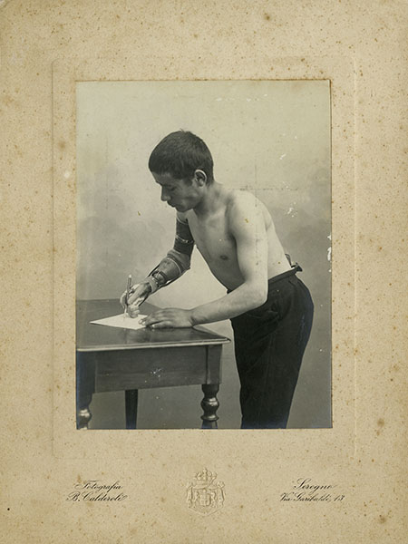 Ritratto fotografico di un uomo amputato con una protesi ideata da Giuliano Vanghetti, inizi sec. XX.