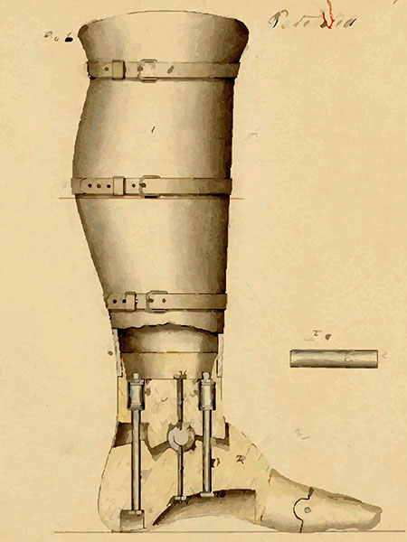 La gamba artificiale brevettata da Douglas Bly nel 1863.